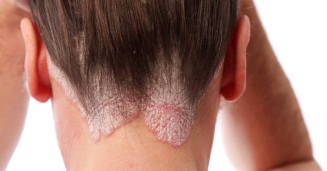 Guia Completo: Tratamentos para as Doenças de Pele Mais Comuns