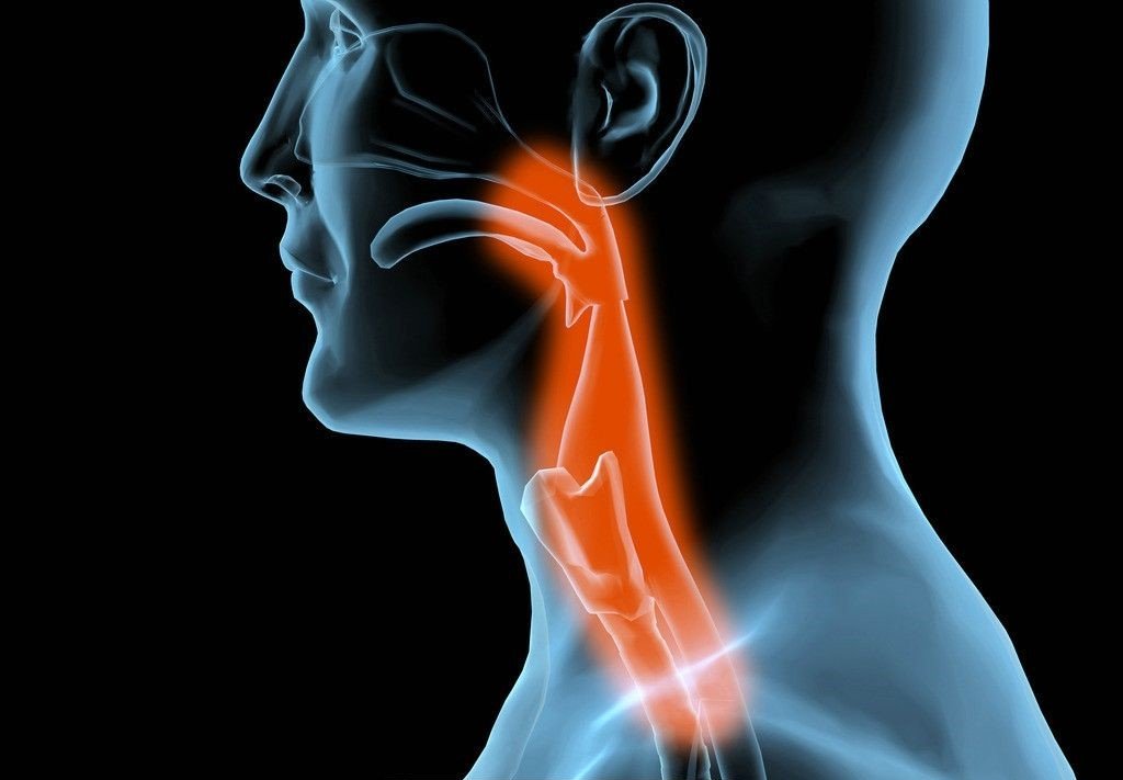 Refluxo e Dor de Garganta: Entenda a Conexão