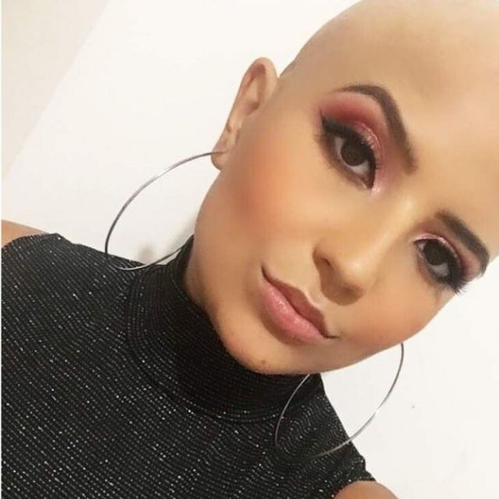 Como escolher o melhor tricologista em Vitória para seu caso?