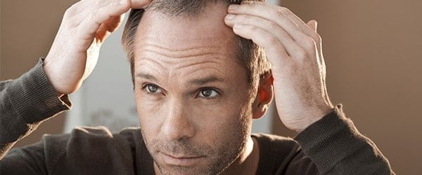 Como Escolher o Melhor Tricologista para Doenças do Couro Cabeludo em SP