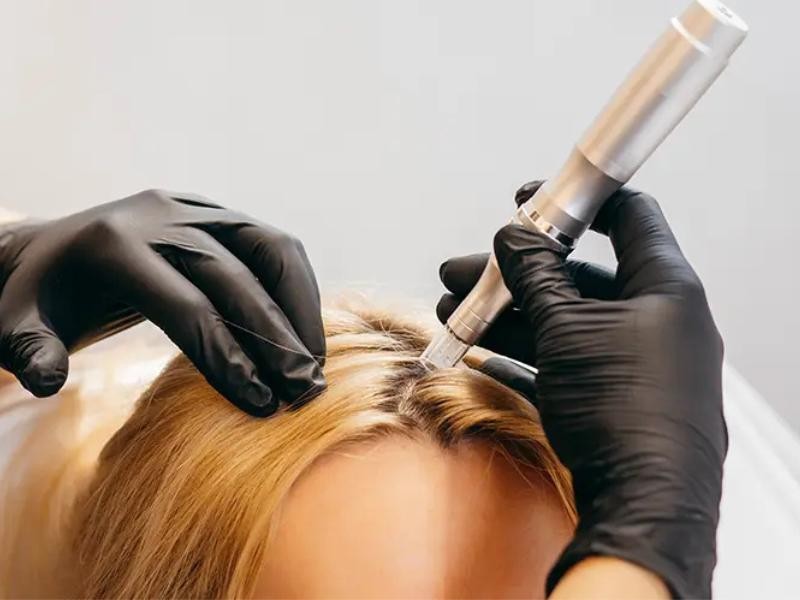 5 ideias de títulos:
1. Micropigmentação Capilar no Rio de Janeiro: Guia Completo dos Melhores Especialistas
2. Como a Micropigmentação Capilar Transforma a Aparência e a Autoestima
3. Entenda as Técnicas de Micropigmentação Capilar: Nano Pontos vs. 4D
4. Micropigmentação Capilar: O Que Esperar do Pós-Procedimento e Cuidados Essenciais
5. Especialistas em Micropigmentação Capilar: Onde Encontrar os Melhores no RJ