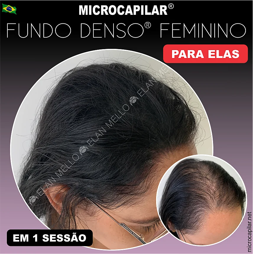 Especialista em microcapilar no Rio de Janeiro