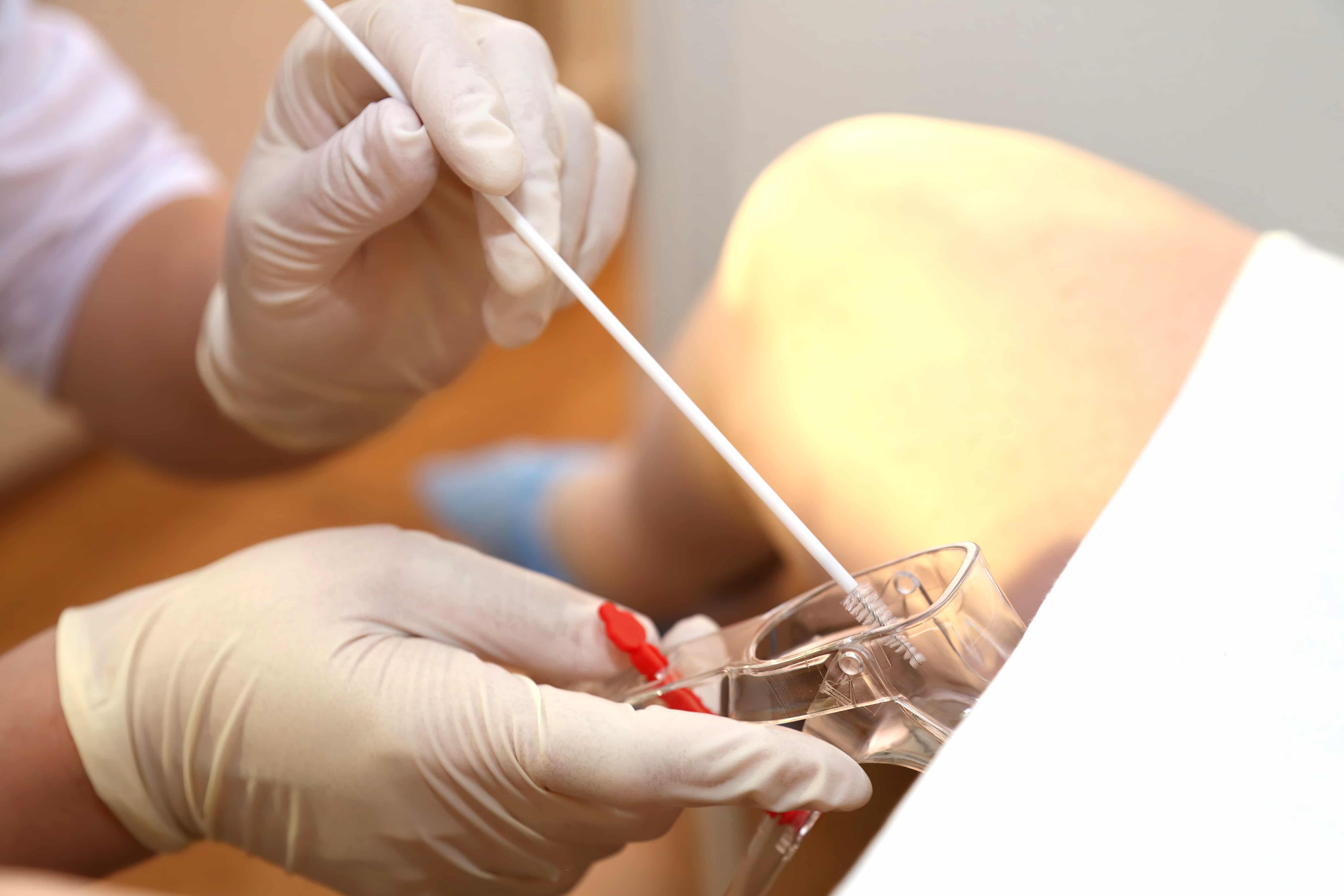 Exame Papanicolau Na Gravidez