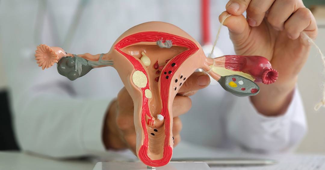 O Que Esperar Durante o Papanicolau na Gravidez?