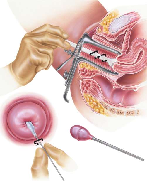 Papanicolau e Gravidez: Segurança e Benefícios para Mãe e Bebê