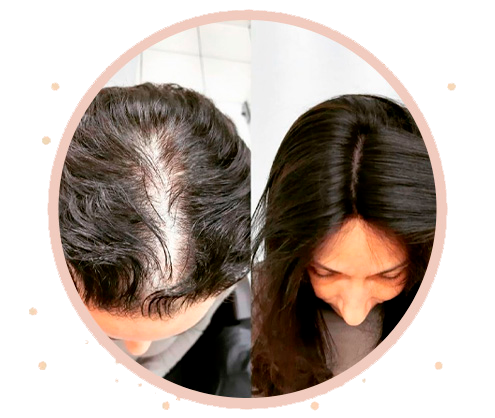 Prótese Capilar: Diferenças entre Atacado e Varejo para Profissionais