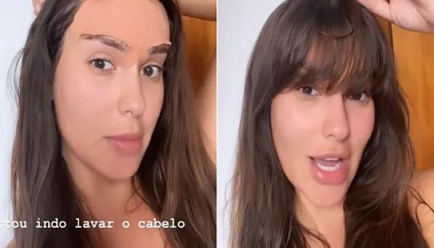 Frontoplastia e Transplante Capilar: Entenda as Diferenças e Combinações