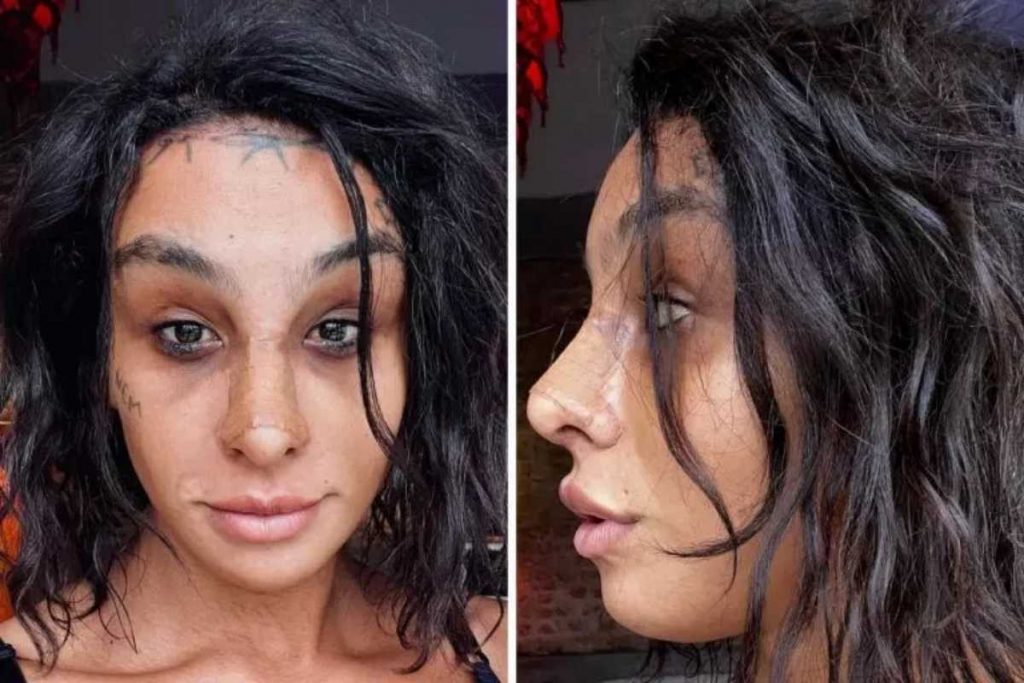 Como Escolher a Clínica Ideal para sua Frontoplastia e Transplante Capilar