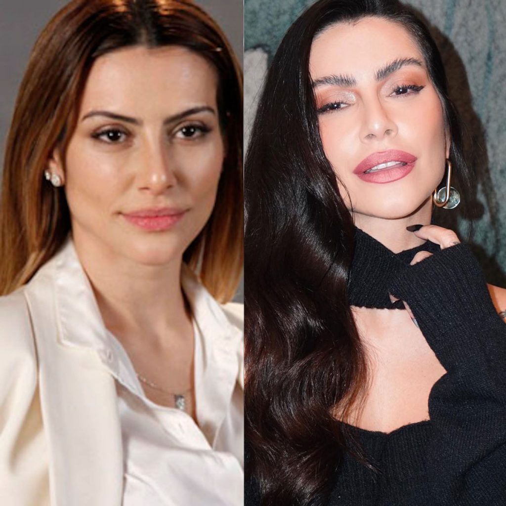 Reversão de harmonização facial