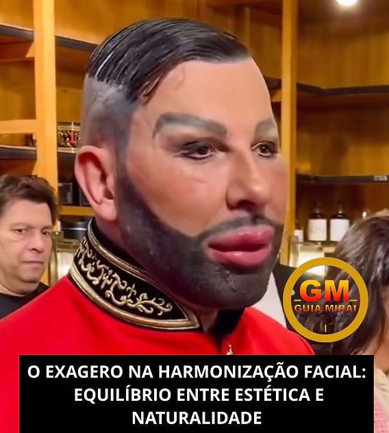 Excesso de preenchimento facial