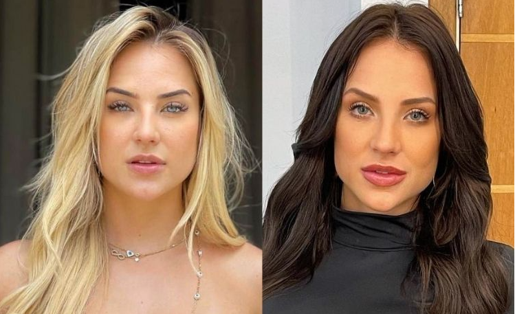 Consequências preenchimento facial excessivo