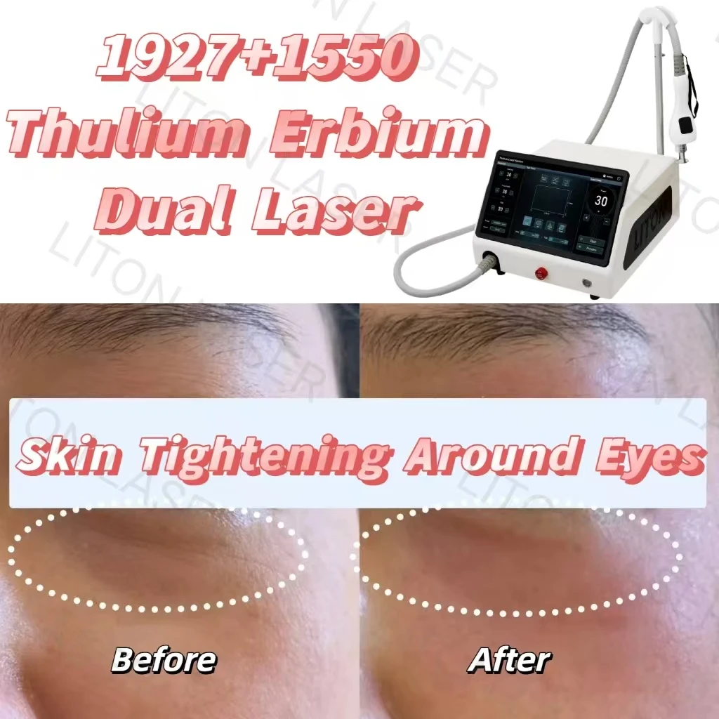 5 ideias de títulos