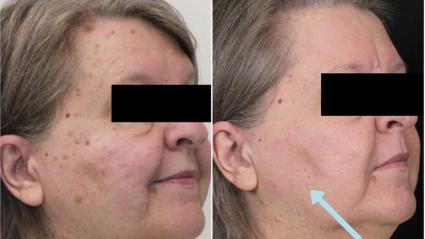 5 ideias de títulos