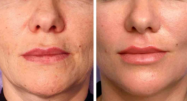 5 ideias de títulos