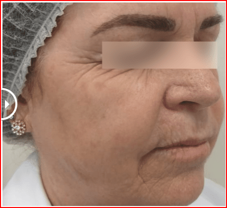 5 ideias de títulos