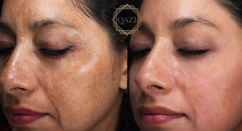 5 ideias de títulos