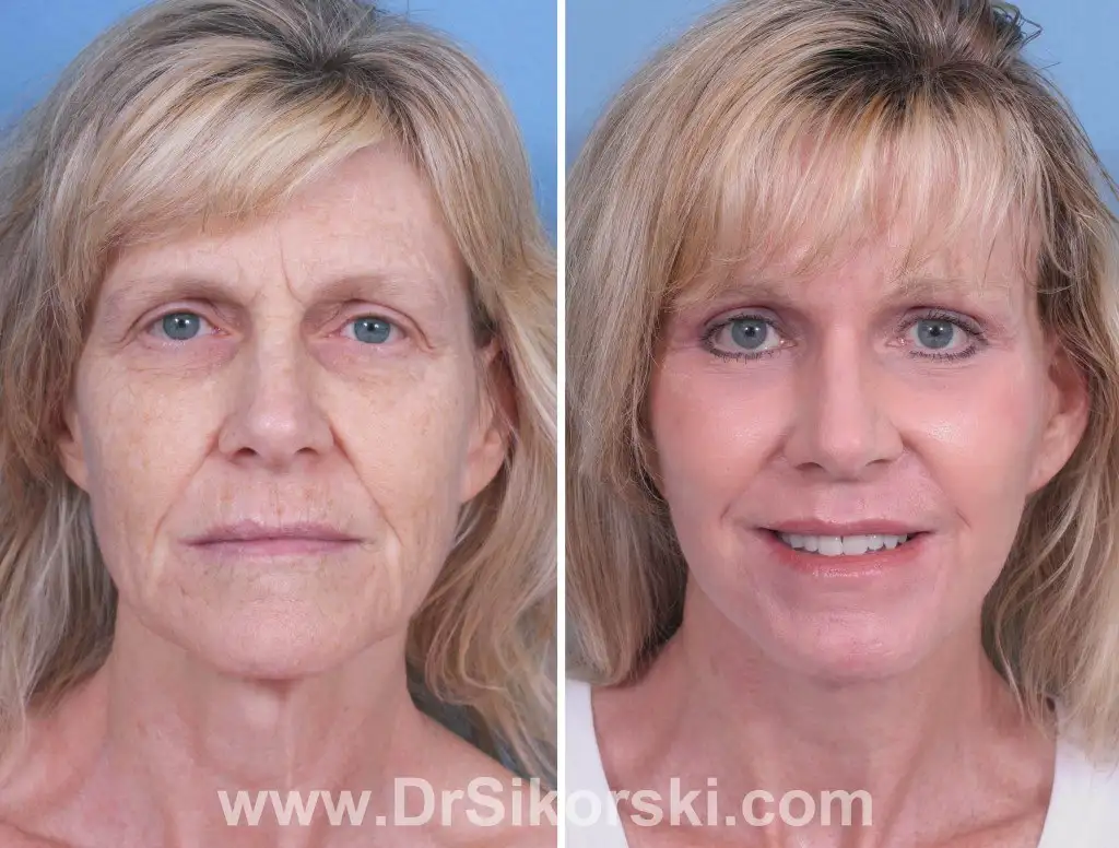 5 ideias de títulos