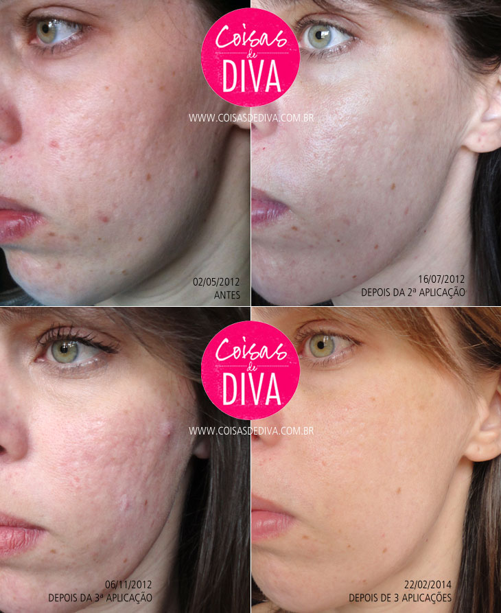 5 ideias de títulos