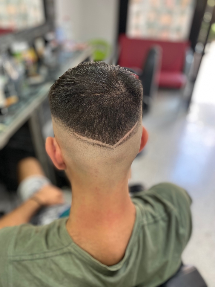 Recuo da Linha Capilar (Hairline): Causas