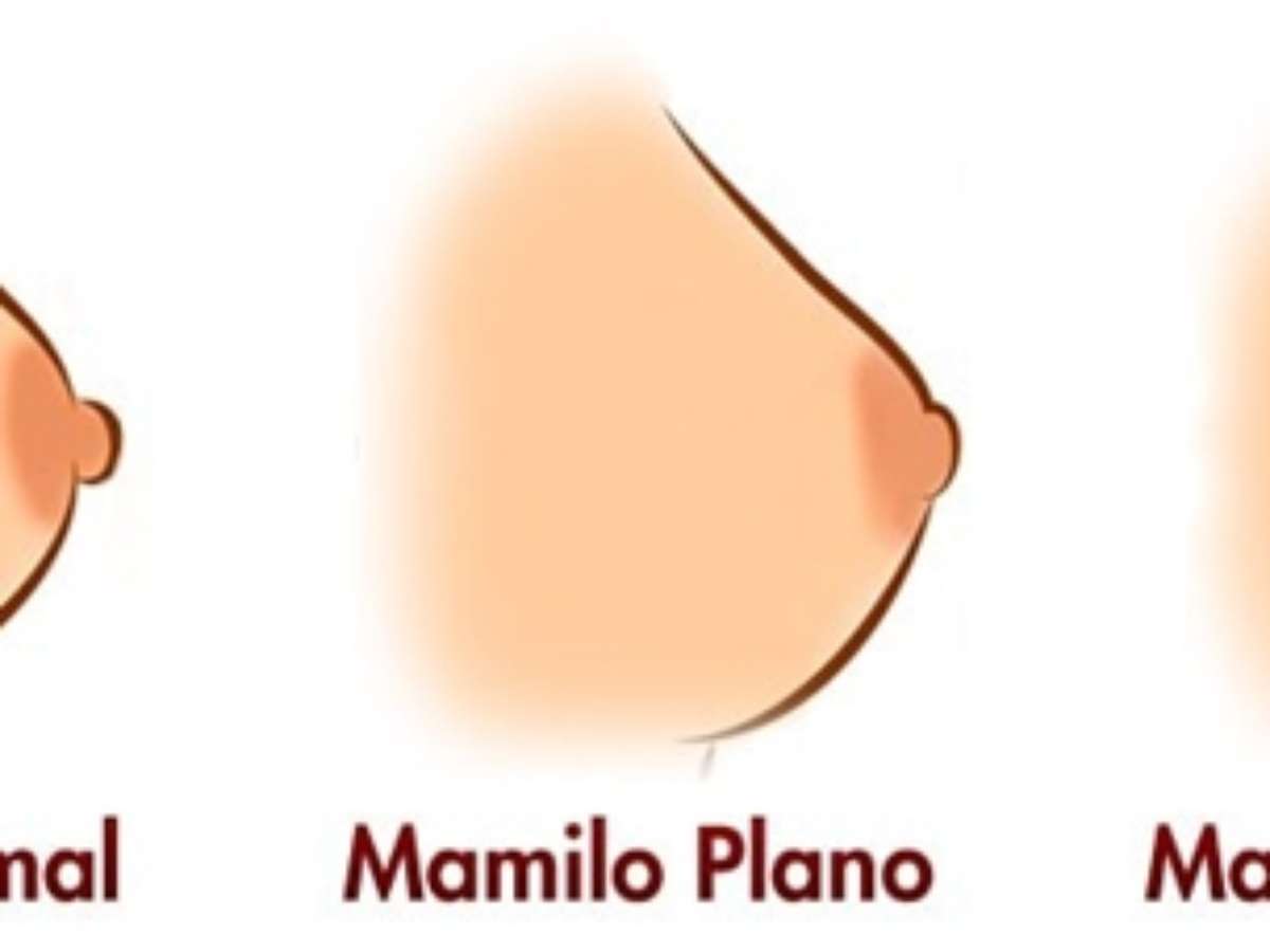 o que fazer quando mamilo invertido causa dor intensa ao amamentar