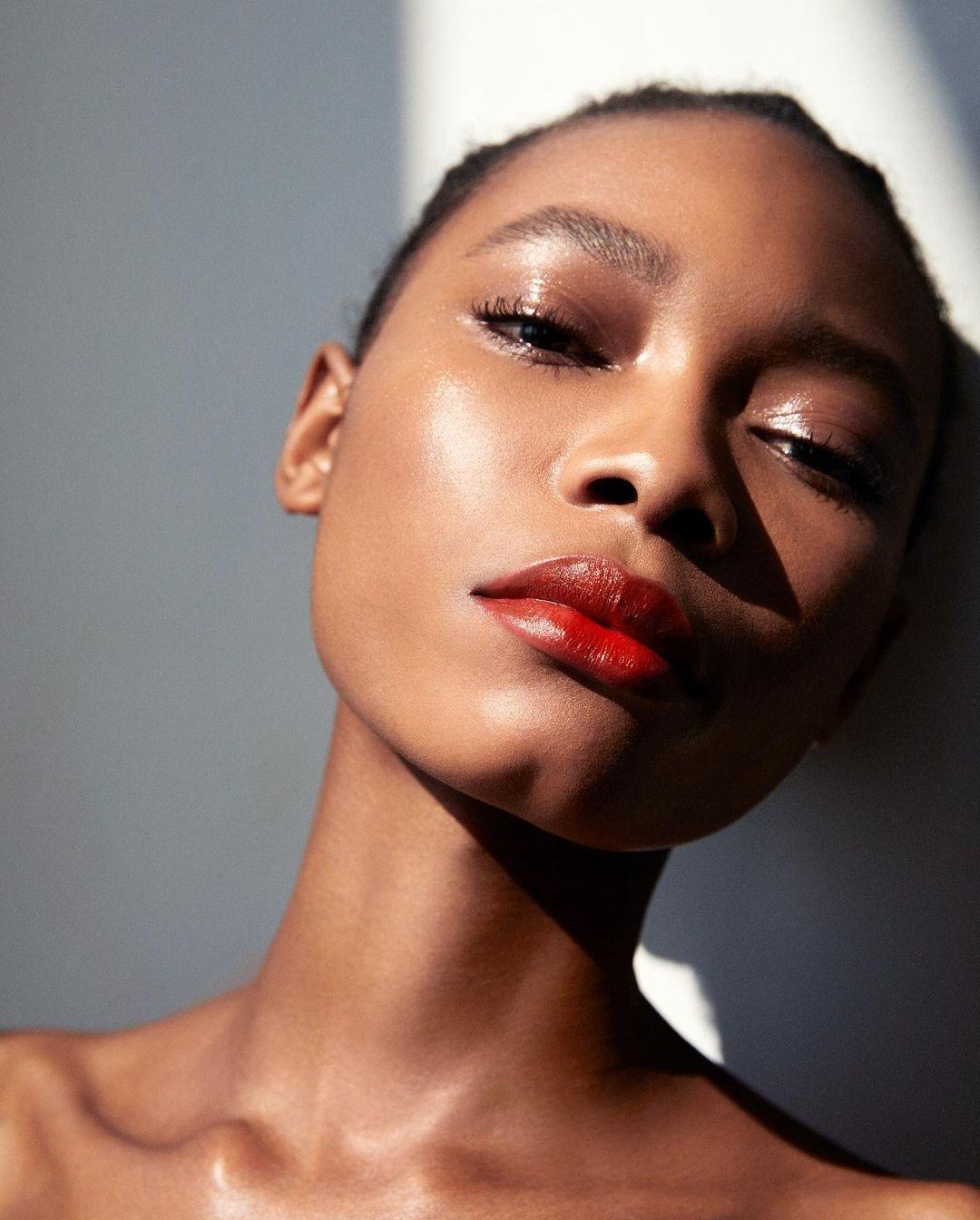 Manchas Na Pele Negra