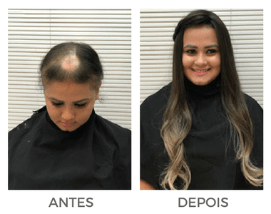 Como Escolher o Melhor Mega Hair de Fita Adesiva para Cabelos Finos