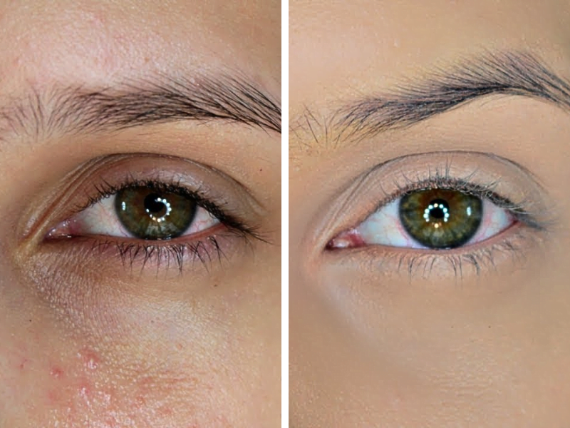 Pele Madura e Olheiras: Os Corretivos que Não Marcam as Linhas de Expressão