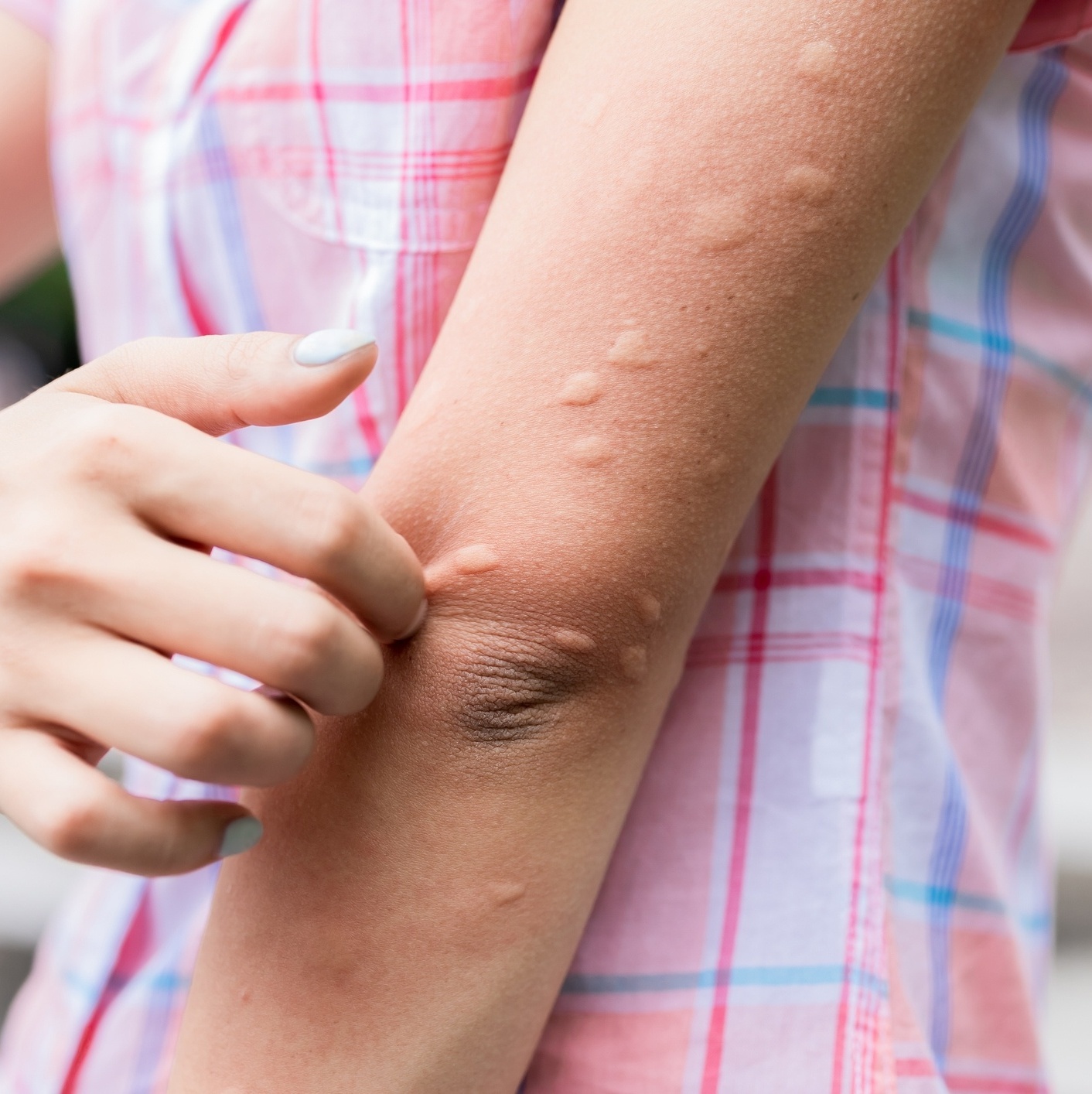 receita armadilha garrafa pet pernilongo