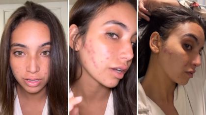 Rotina de Skincare Minimalista: O Básico para uma Pele em Crise