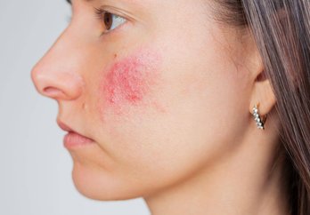 Sintomas e Tratamentos