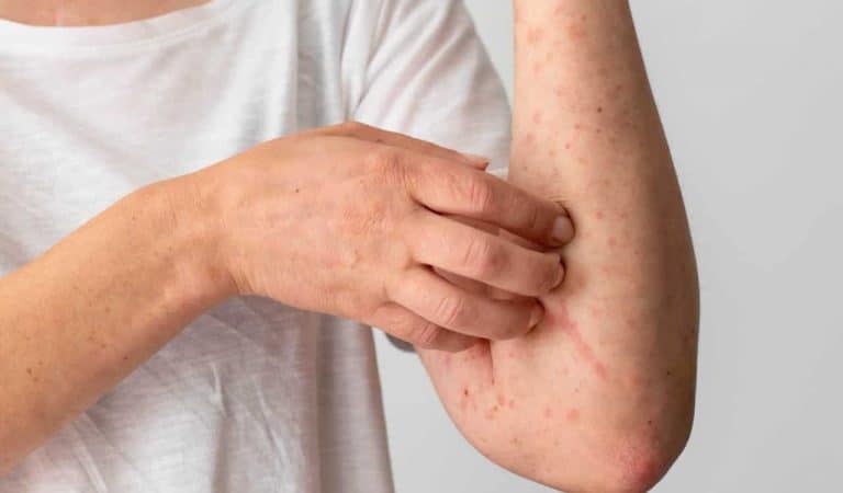 Alimentos e Vitaminas Essenciais para uma Pele Radiante e Saudável