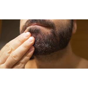 Minoxidil Oral: Quando Considerar a Alternativa em Comprimidos para Queda de Cabelo