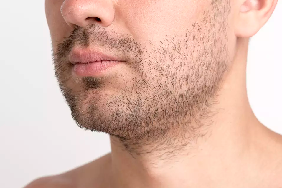 Fórmulas Manipuladas de Minoxidil: Personalize seu Tratamento contra a Coceira