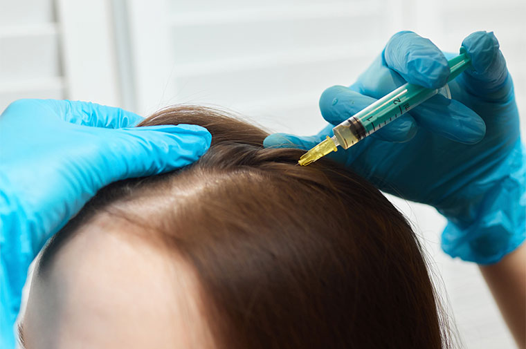 MMP Capilar: O que é e como funciona?