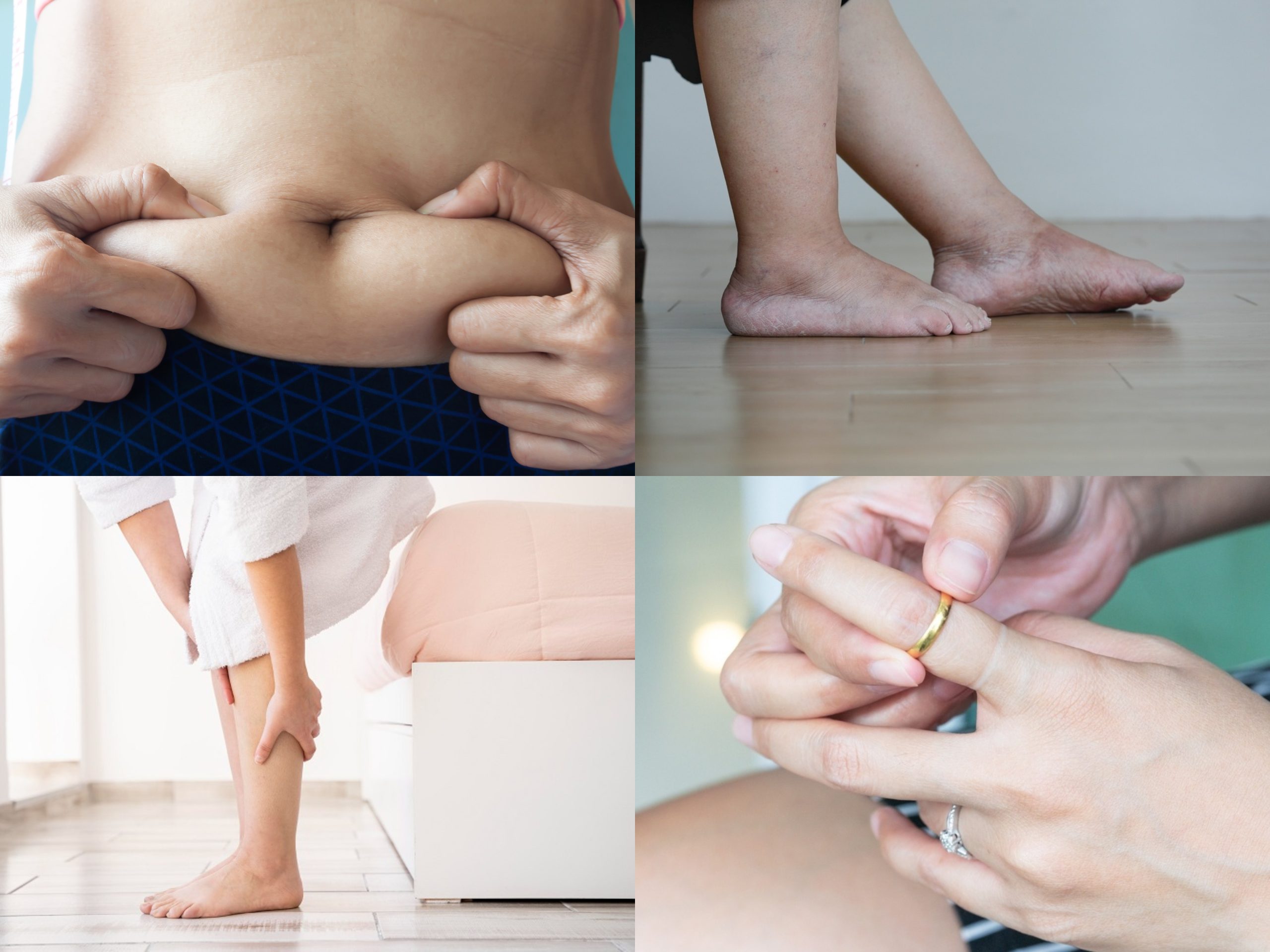 o que causa retenção de líquido no corpo