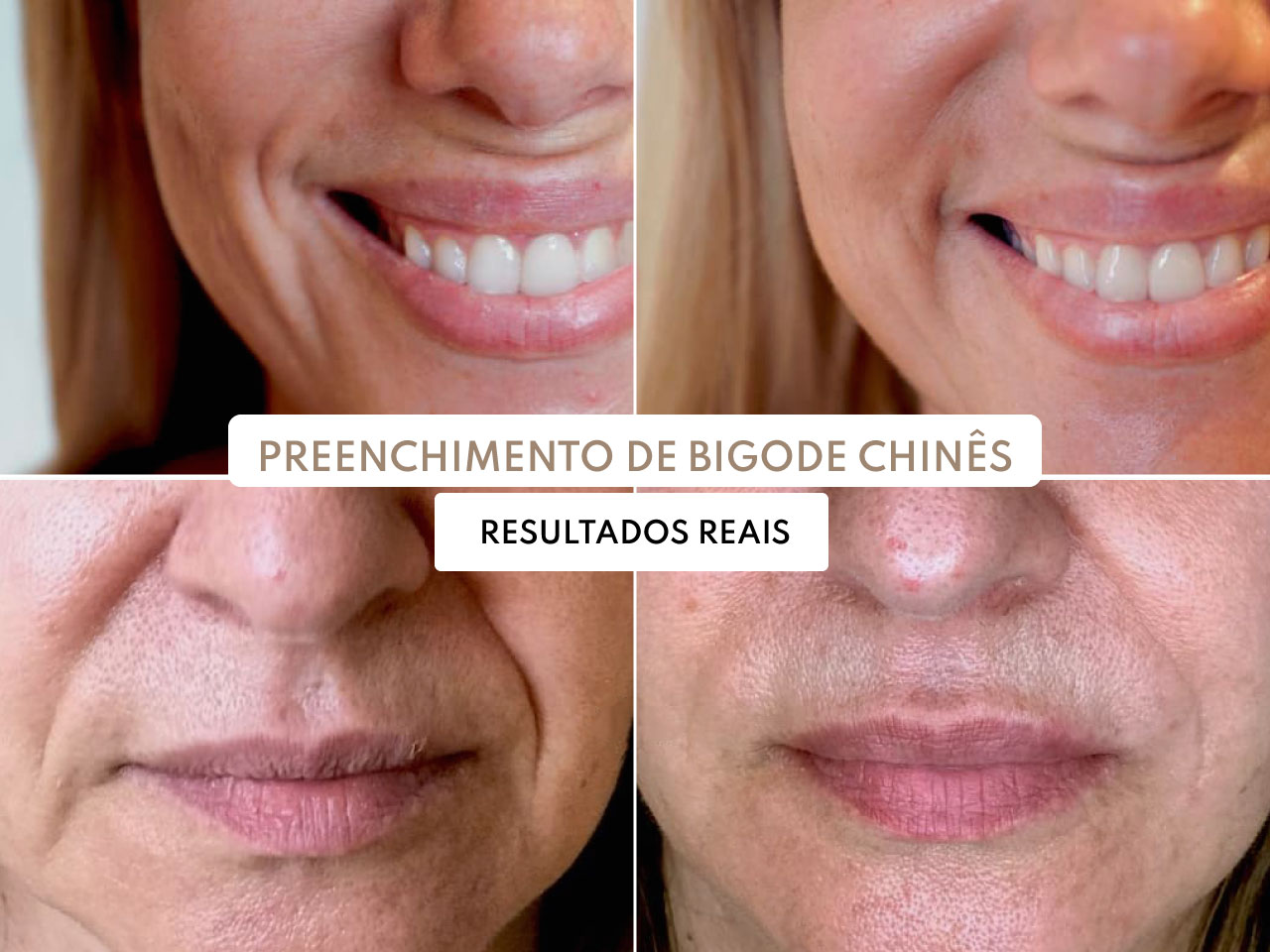 o que é bigode chines