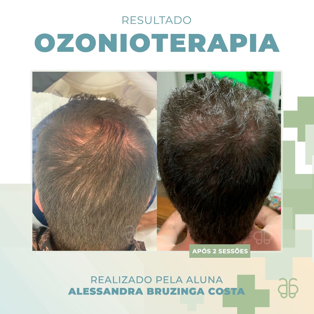ozonio no cabelo