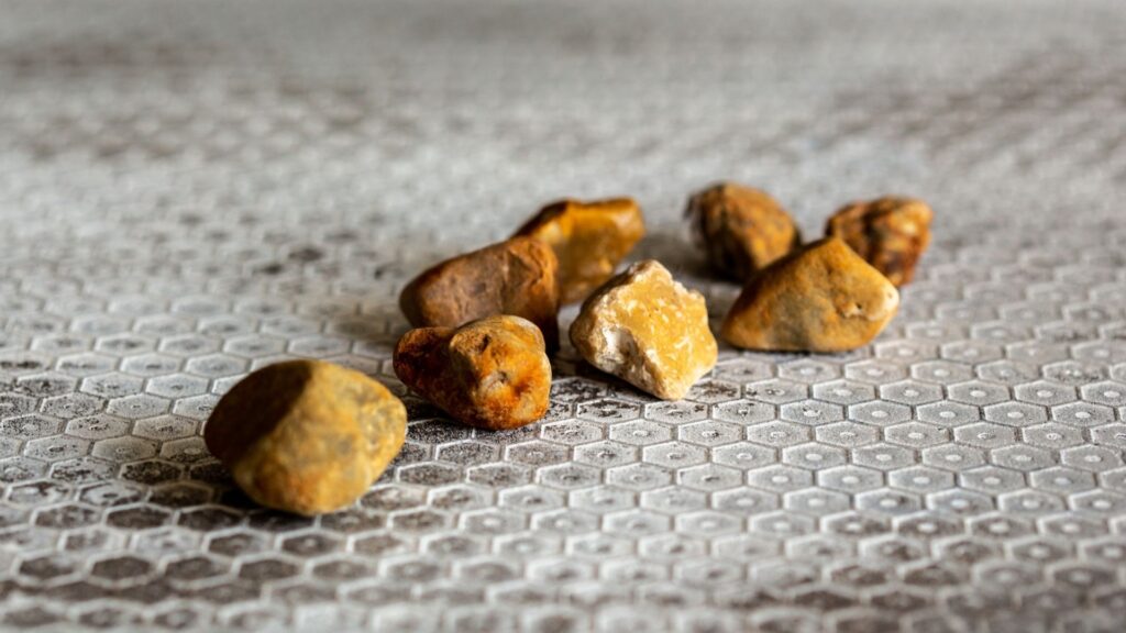 Guia Completo de Alimentos Proibidos e Permitidos para a Saúde da Vesícula