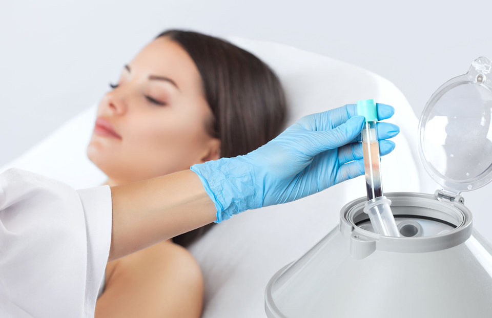 Combinações de terapias capilares: PRP com microagulhamento e laser