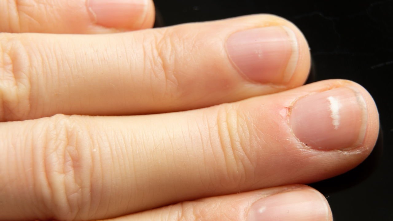 7 dicas para evitar manchas brancas nas unhas