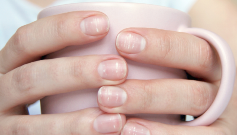 mancha branca na unha trauma ou falta de vitamina