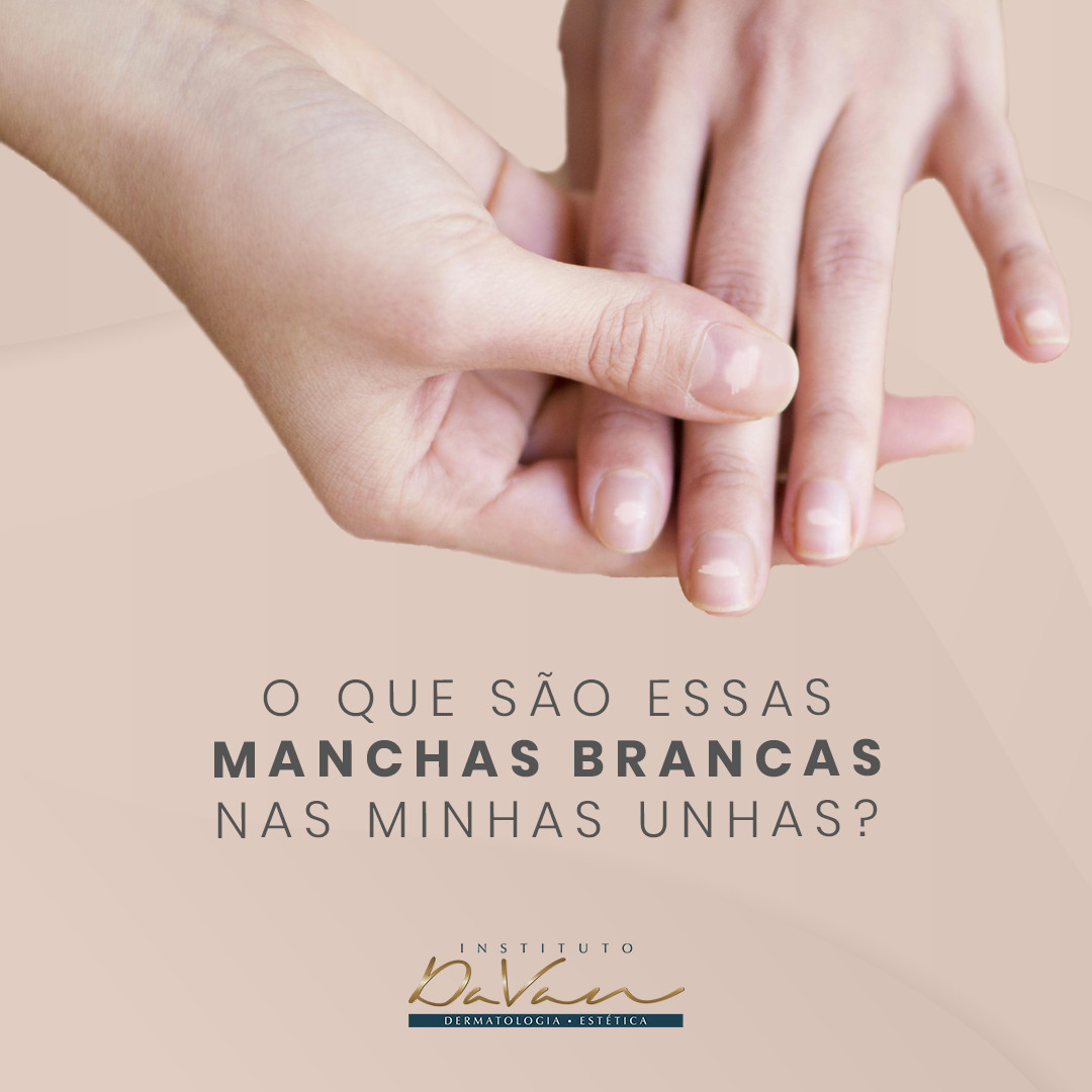 por que minhas unhas estão com manchas brancas