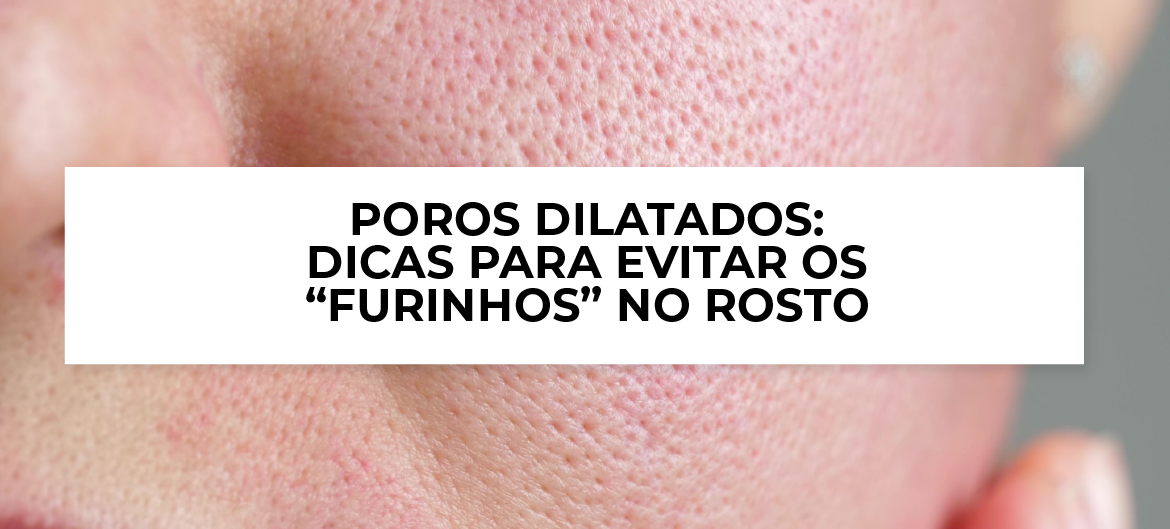 poros dilatados o que fazer