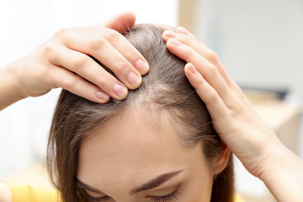 Causas e Tratamentos; Queda de Cabelo em Mulheres: Quando Procurar um Especialista?; Tricoscopia e Outros Exames Essenciais para Alopecia Feminina; Minoxidil e Alopecia Feminina: Mitos e Verdades sobre o Tratamento; Dieta e Hormônios: A Relação com a Queda de Cabelo em Mulheres