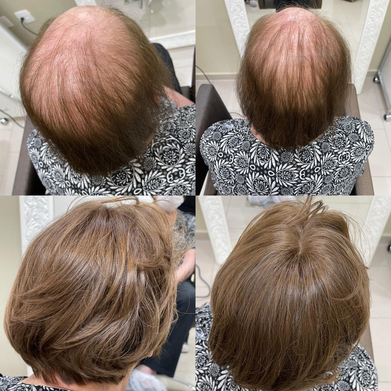 Prótese capilar feminina fios naturais SP