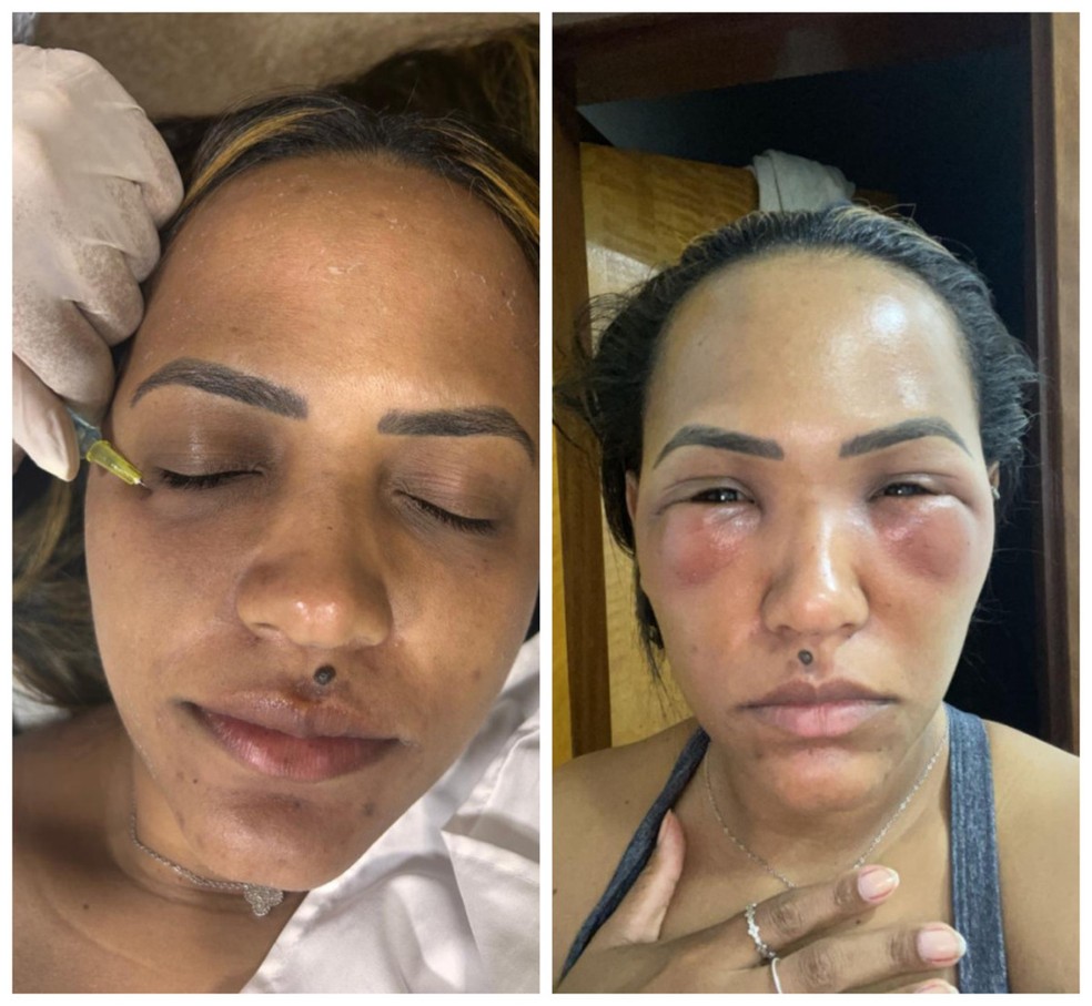 o que fazer quando o olho incha e dói