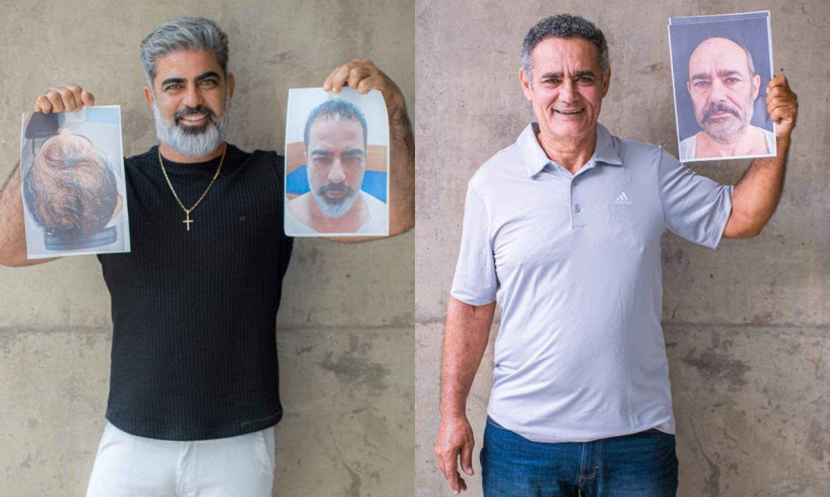 5 ideias de títulos:
1. Realidade Aumentada no Transplante Capilar: O Futuro Já Chegou!
2. Como a RA Está Revolucionando o Planejamento de Transplantes Capilares
3. Veja Seu Novo Cabelo Antes da Cirurgia: O Poder da RA
4. Precisão Cirúrgica Aumentada: A RA na Implantação Capilar
5. Benefícios Inovadores da Realidade Aumentada para o Transplante Capilar