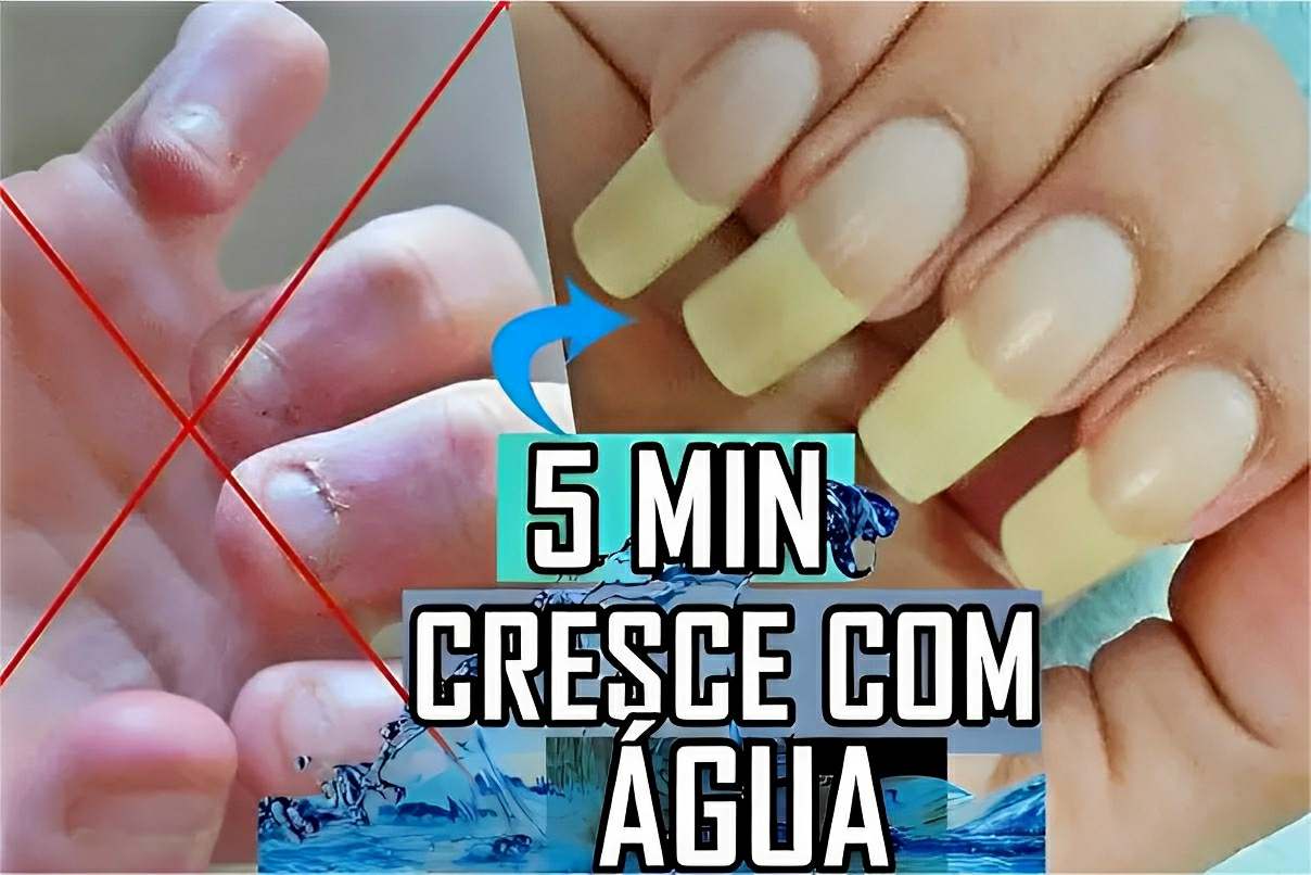 Acetona vs. Removedor Sem Acetona: Qual o Melhor para Suas Unhas?