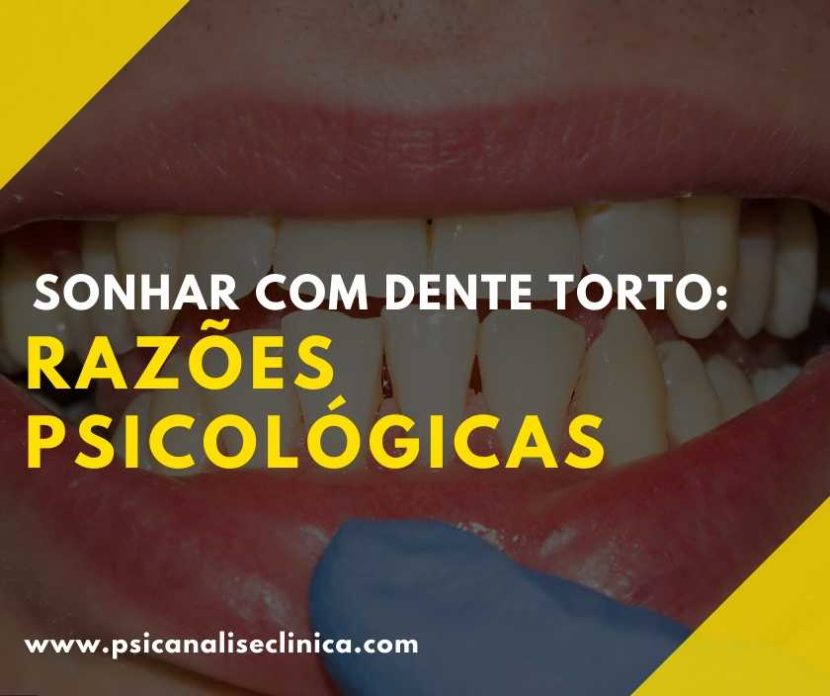 Sonhar Com Dentes Tortos