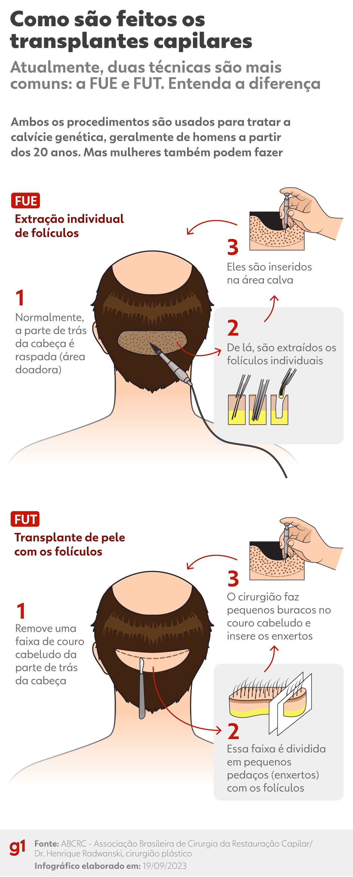 Guia Completo de Suplementos Pós-Transplante Capilar